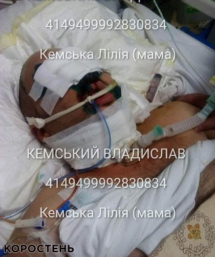 Коростенцю Владиславу Кемському, який отримав важкі поранення, потрібна допомога