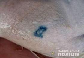 Поліцейські просять допомогти встановити особу чоловіка, тіло якого знайшли у водоймі поблизу Коростеня майже 2 роки тому